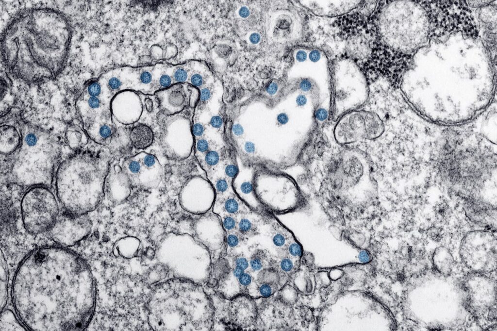 détection des pathogènes par maldi-tof